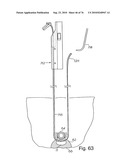 DEVICES FOR MINIMALLY INVASIVE PELVIC SURGERY diagram and image