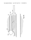 DEVICES FOR MINIMALLY INVASIVE PELVIC SURGERY diagram and image