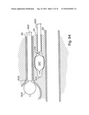 DEVICES FOR MINIMALLY INVASIVE PELVIC SURGERY diagram and image