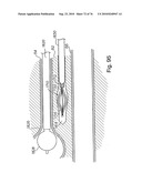 DEVICES FOR MINIMALLY INVASIVE PELVIC SURGERY diagram and image