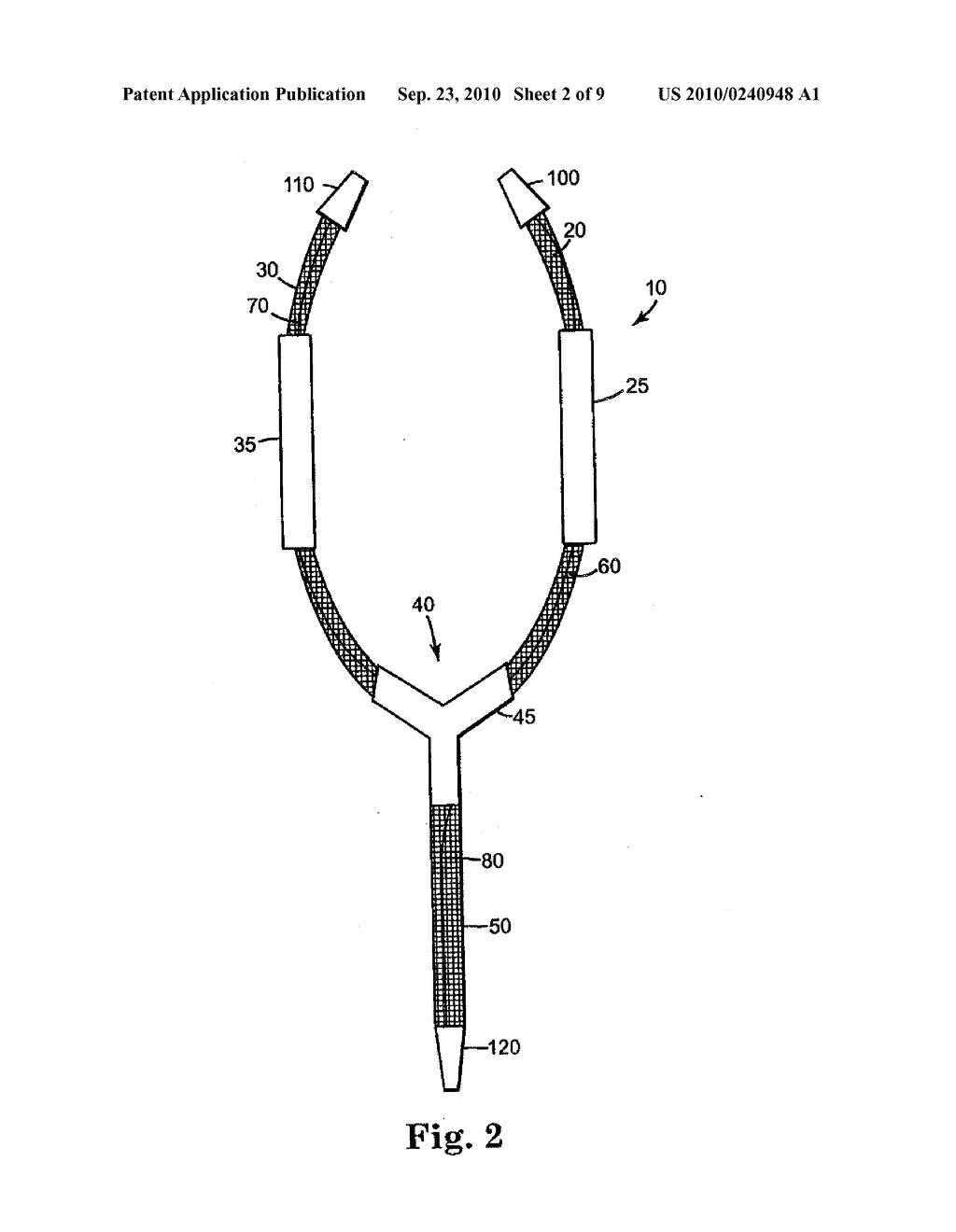 MALE URETHRAL PROSTHESIS WITH TENSIONING MEMBER - diagram, schematic, and image 03