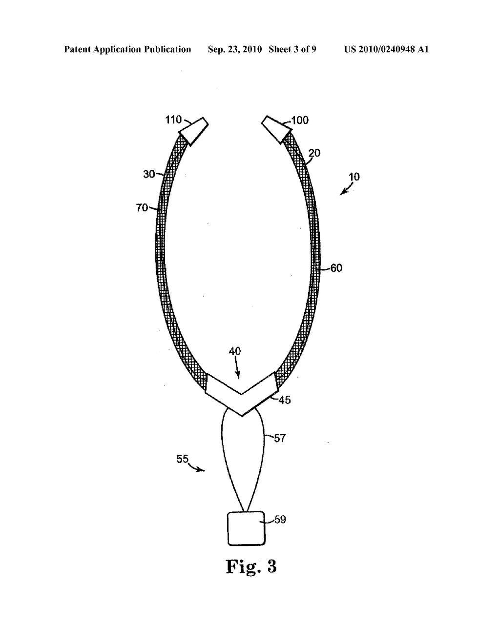 MALE URETHRAL PROSTHESIS WITH TENSIONING MEMBER - diagram, schematic, and image 04