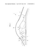 ENDOSCOPY METHOD AND ENDOSCOPE diagram and image