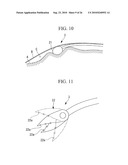 ENDOSCOPY METHOD AND ENDOSCOPE diagram and image