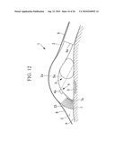 ENDOSCOPY METHOD AND ENDOSCOPE diagram and image