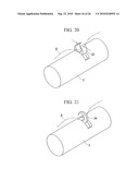 ENDOSCOPY METHOD AND ENDOSCOPE diagram and image