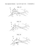 ENDOSCOPY METHOD AND ENDOSCOPE diagram and image