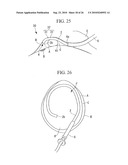 ENDOSCOPY METHOD AND ENDOSCOPE diagram and image