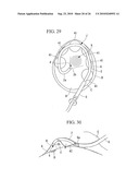 ENDOSCOPY METHOD AND ENDOSCOPE diagram and image