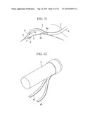 ENDOSCOPY METHOD AND ENDOSCOPE diagram and image