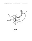 MEDICAL DEVICE POSITIONING SYSTEM diagram and image