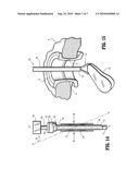 FLEXIBLE PORT SEAL diagram and image