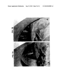 ROBOT FOR COMPUTED TOMOGRAPHY INTERVENTIONS diagram and image