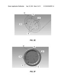 SYSTEM AND METHOD FOR TREATING TUMORS diagram and image