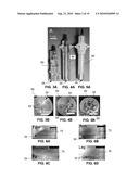 SYSTEM AND METHOD FOR TREATING TUMORS diagram and image