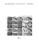 SYSTEM AND METHOD FOR TREATING TUMORS diagram and image