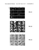 SYSTEM AND METHOD FOR TREATING TUMORS diagram and image