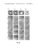 SYSTEM AND METHOD FOR TREATING TUMORS diagram and image