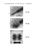 SYSTEM AND METHOD FOR TREATING TUMORS diagram and image