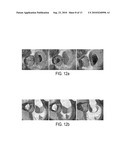 VALVE ASSESSMENT FROM MEDICAL DIAGNOSTIC IMAGING DATA diagram and image