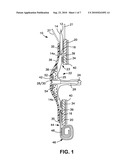 OSTOMY APPLIANCE diagram and image