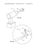 Tissue Cavitation Device and Method diagram and image