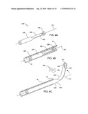 Tissue Cavitation Device and Method diagram and image