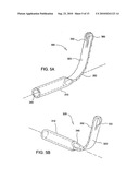 Tissue Cavitation Device and Method diagram and image