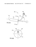 Tissue Cavitation Device and Method diagram and image