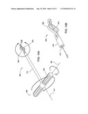 Tissue Cavitation Device and Method diagram and image