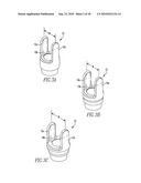 Soft Tissue Manipulator Assembly diagram and image