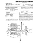 Methods and instrumentation for distraction of a disc space diagram and image