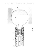 METHODS, SYSTEMS, AND DEVICES FOR DEPLOYING AN EMBOLIC PROTECTION FILTER diagram and image