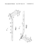 Anatomical Distal Radius Fracture Fixation Plate With Ulnar Buttress diagram and image