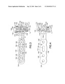 Anatomical Distal Radius Fracture Fixation Plate With Ulnar Buttress diagram and image