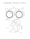 INFLATABLE MEDICAL DEVICES diagram and image