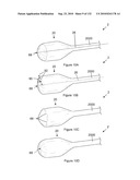 INFLATABLE MEDICAL DEVICES diagram and image