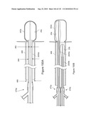 INFLATABLE MEDICAL DEVICES diagram and image