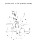 INFLATABLE MEDICAL DEVICES diagram and image