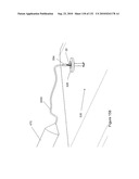 INFLATABLE MEDICAL DEVICES diagram and image