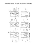 INFLATABLE MEDICAL DEVICES diagram and image