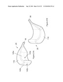 INFLATABLE MEDICAL DEVICES diagram and image