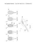 INFLATABLE MEDICAL DEVICES diagram and image