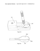 INFLATABLE MEDICAL DEVICES diagram and image