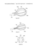 INFLATABLE MEDICAL DEVICES diagram and image