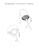 INFLATABLE MEDICAL DEVICES diagram and image