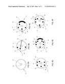 STEERABLE EPICARDIAL PACING CATHETER SYSTEM PLACED VIA THE SUBXIPHOID PROCESS diagram and image