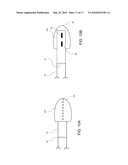 STEERABLE EPICARDIAL PACING CATHETER SYSTEM PLACED VIA THE SUBXIPHOID PROCESS diagram and image