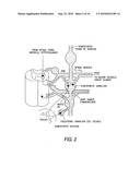 Nerve Stimulation For Treatment of Obesity, Metabolic Syndrome, and Type 2 Diabetes diagram and image