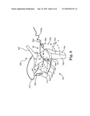 METHOD AND APPARATUS FOR ASSISTING DEGLUTITION diagram and image